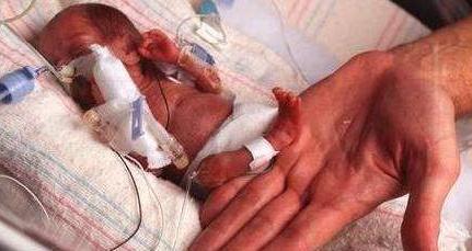 女嬰先天缺失皮膚 鮮紅肌肉暴露在外 醫生提醒孕婦要注意孕期環境 女嬰先天缺失皮膚 鮮紅肌肉暴露在外 醫生提醒孕婦要注意孕期環境