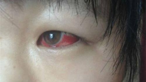 光觸媒除甲醛保護(hù)新裝修教室空氣,更保護(hù)孩子們 光觸媒除甲醛保護(hù)新裝修教室空氣,更保護(hù)孩子們
